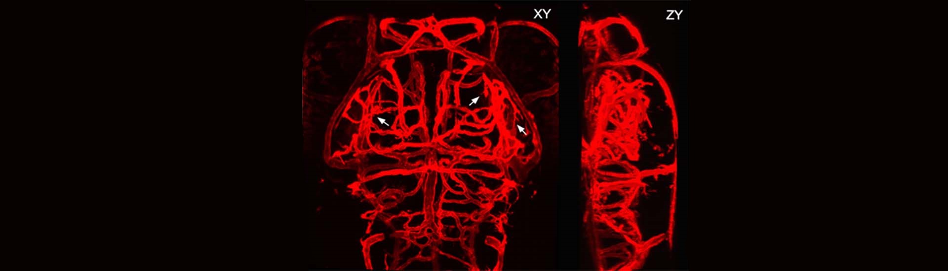 中科院腦科學(xué)與智能技術(shù)卓越中心（神經(jīng)科學(xué)研究所）杜久林研究組發(fā)現(xiàn)大腦三維血管網(wǎng)絡(luò)形成的細(xì)胞和分子機(jī)制